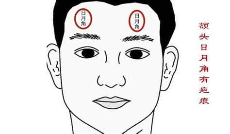 額頭起角|面相解讀——額頭日月角